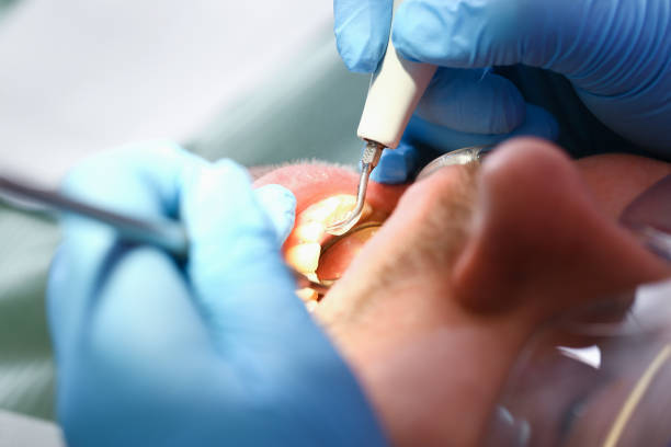 Best Emergency Gum Treatment in Browns Lake, WI