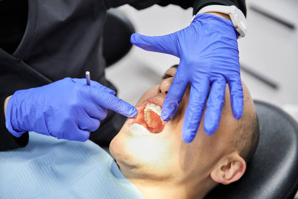 Best Emergency Tooth Extraction in Browns Lake, WI